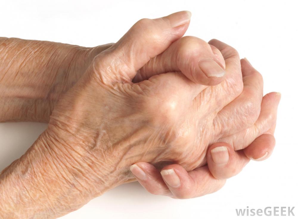ARTHRITIS INCREASES RISK OF LUNG DISEASE | Disability Talk